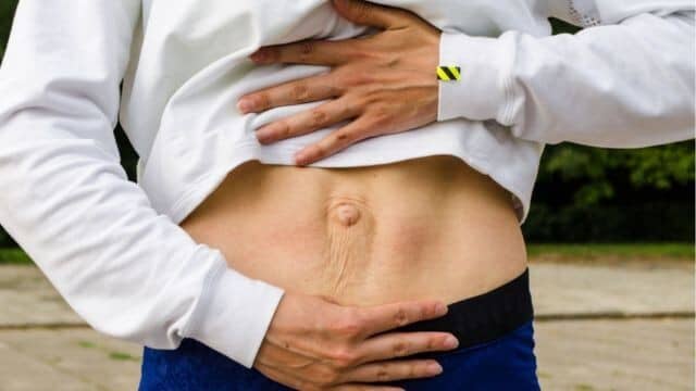 diastasis des grands droits