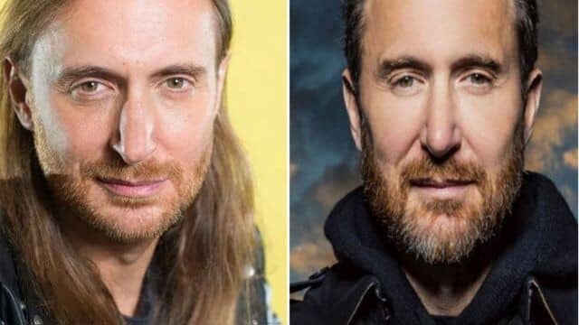 david guetta chirurgie esthétique