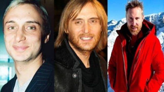david guetta chirurgie esthétique