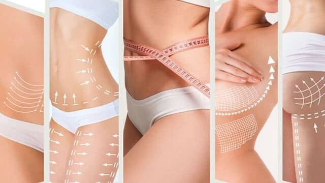 faire une liposuccion en tunisie en 2025