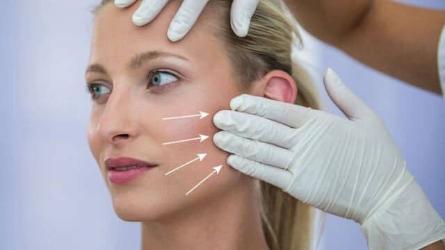 lifting cervico-facial tunisie 2025