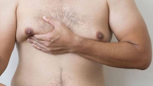 gynecomastie tunisie