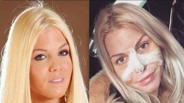 jessica thivenin avant chirurgie esthétique