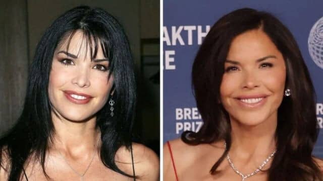 lauren sanchez chirurgie esthétique