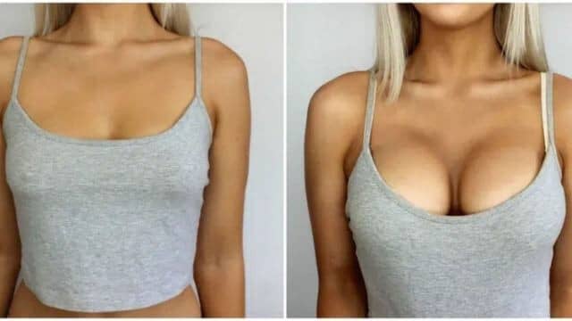 lifting des seins tunisie
