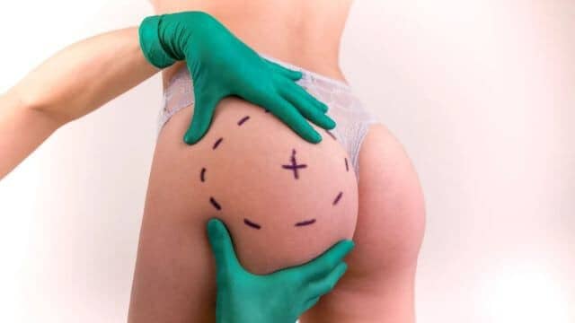 lifting fesses tunisie