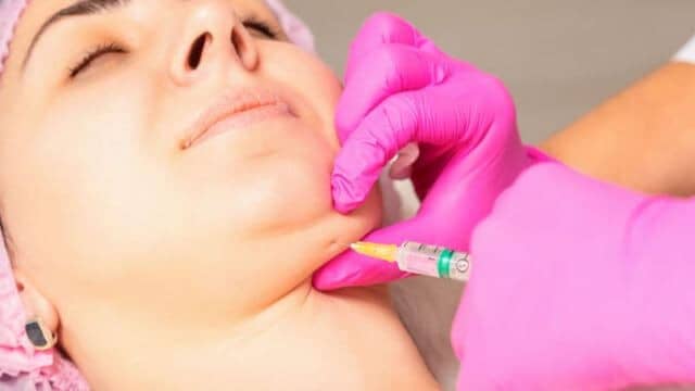 liposuccion menton