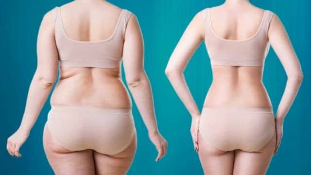 liposuccion poignees damour tunisie