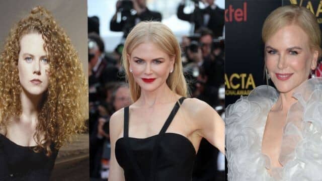 nicole kidman chirurgie esthétique