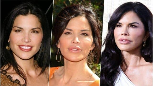 rachida dati chirurgie esthétique