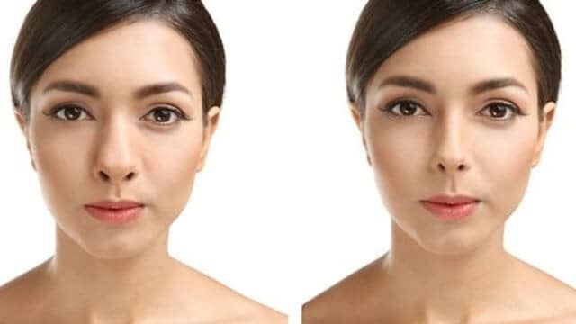 rhinoplastie nez grec