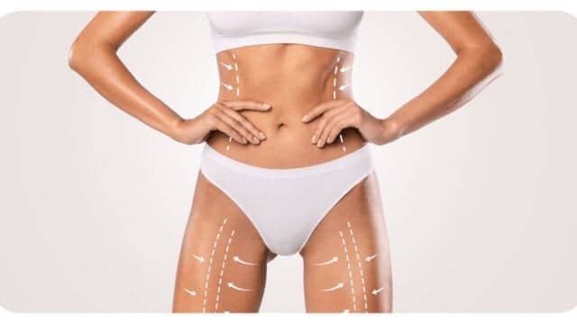 Liposuccion vaser tunisie