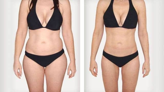 lifting cervico-facial tunisie