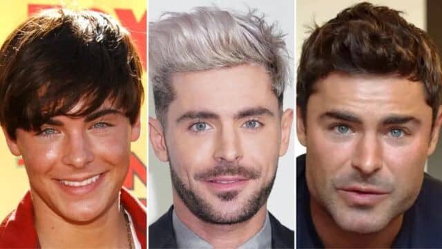 zac efron chirurgie esthétique