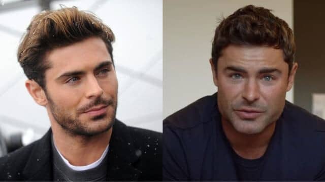 zac efron chirurgie esthétique