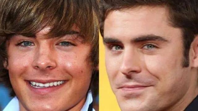 zac efron chirurgie esthétique