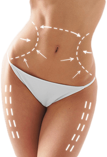 liposuccion tunisie idealmed